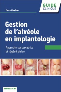 Gestion de l’alvéole en implantologie